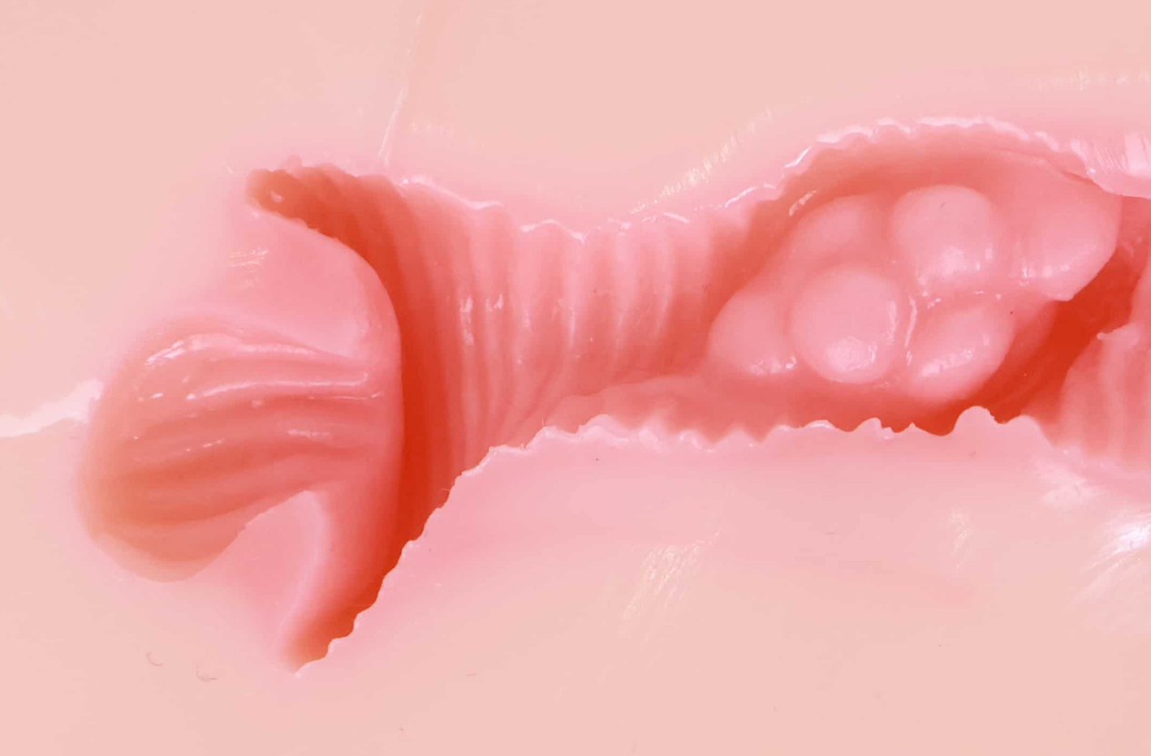 末端大颗粒子宫腔.png 末端大颗粒子宫腔.png